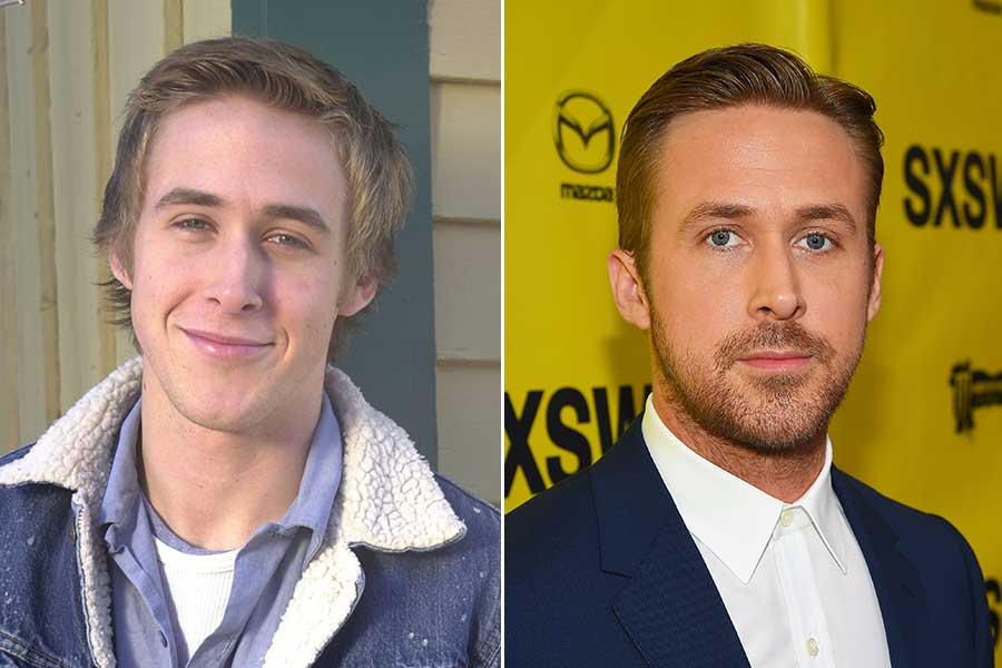 Ryan Gosling chirurgia estetica uomo rinoplastica